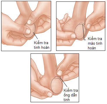 Xử lý sự cố khi 'hành sự'