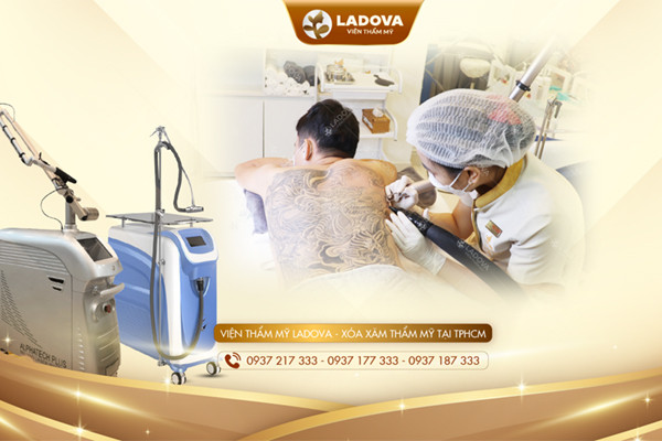 Viện Thẩm Mỹ Ladova xóa xăm không sẹo, sạch mực bằng laser