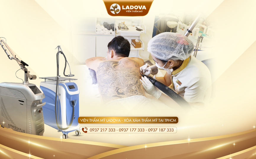 Viện Thẩm Mỹ Ladova xóa xăm không sẹo, sạch mực bằng laser