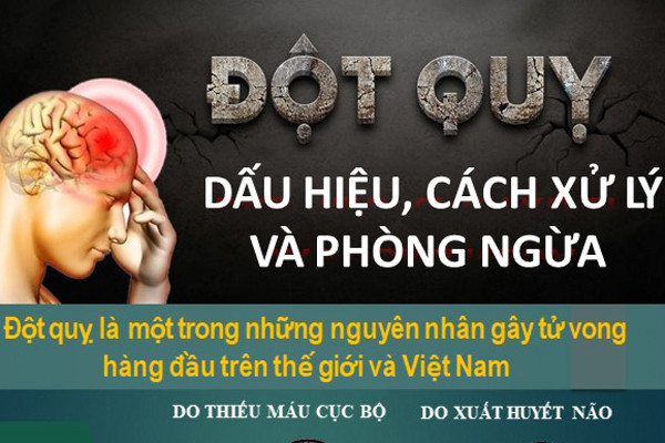 Đột quỵ - Dấu hiệu, cách xử lý và phòng ngừa