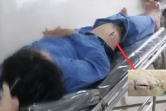 Cán bộ Cục Thuế Ninh Bình bị đâm trước cổng Trường Chính trị - 1