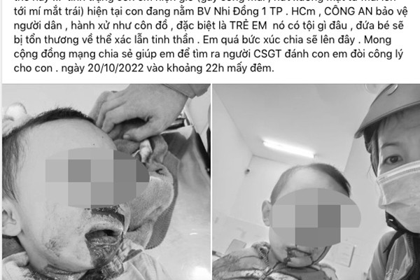 Công an Tiền Giang lên tiếng thông tin tố 'CSGT đánh bé trai'