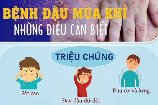 Bệnh đậu mùa khỉ - những điều cần biết