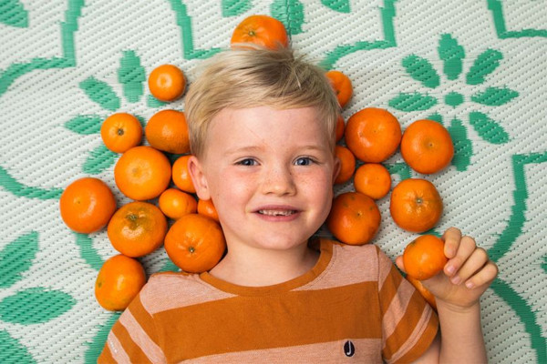 Sở thích ăn loại quả quen thuộc khiến cậu bé đổi màu da