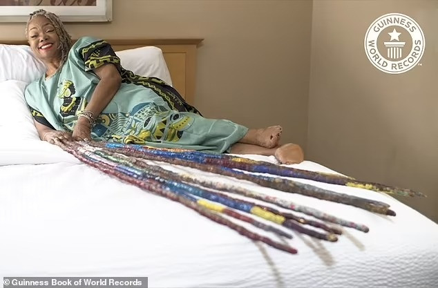 Bi kịch khiến người phụ nữ không cắt móng tay suốt 25 năm - 2