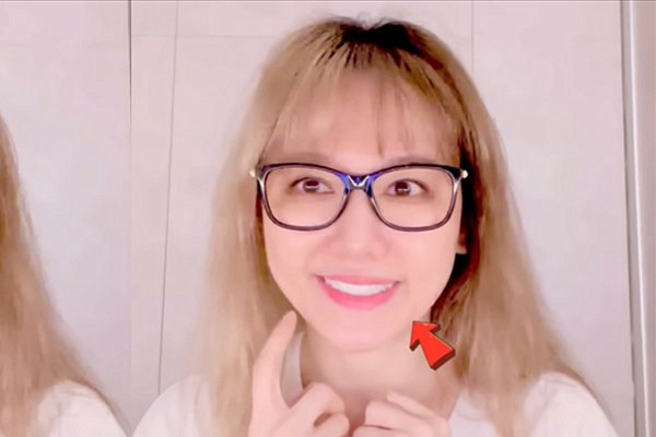 Hari Won - vợ Trấn Thành tiết lộ bệnh tình liệt cơ mặt