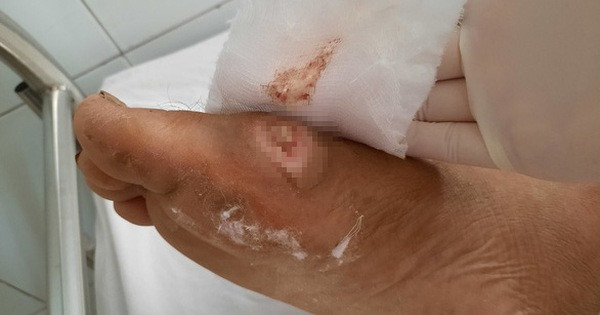 3 người bất ngờ phát hiện mắc bệnh Whitmore, có bé suy tạng phải thở máy