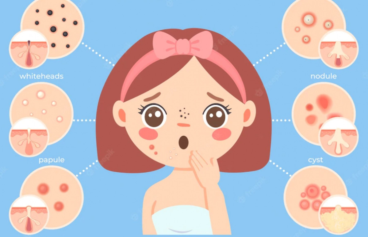 nhung hiem hoa khon luong khi tre day thi som hinh anh 1