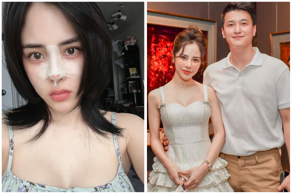 MC Bạch Lan Phương - bạn gái Huỳnh Anh can thiệp ‘dao kéo’
