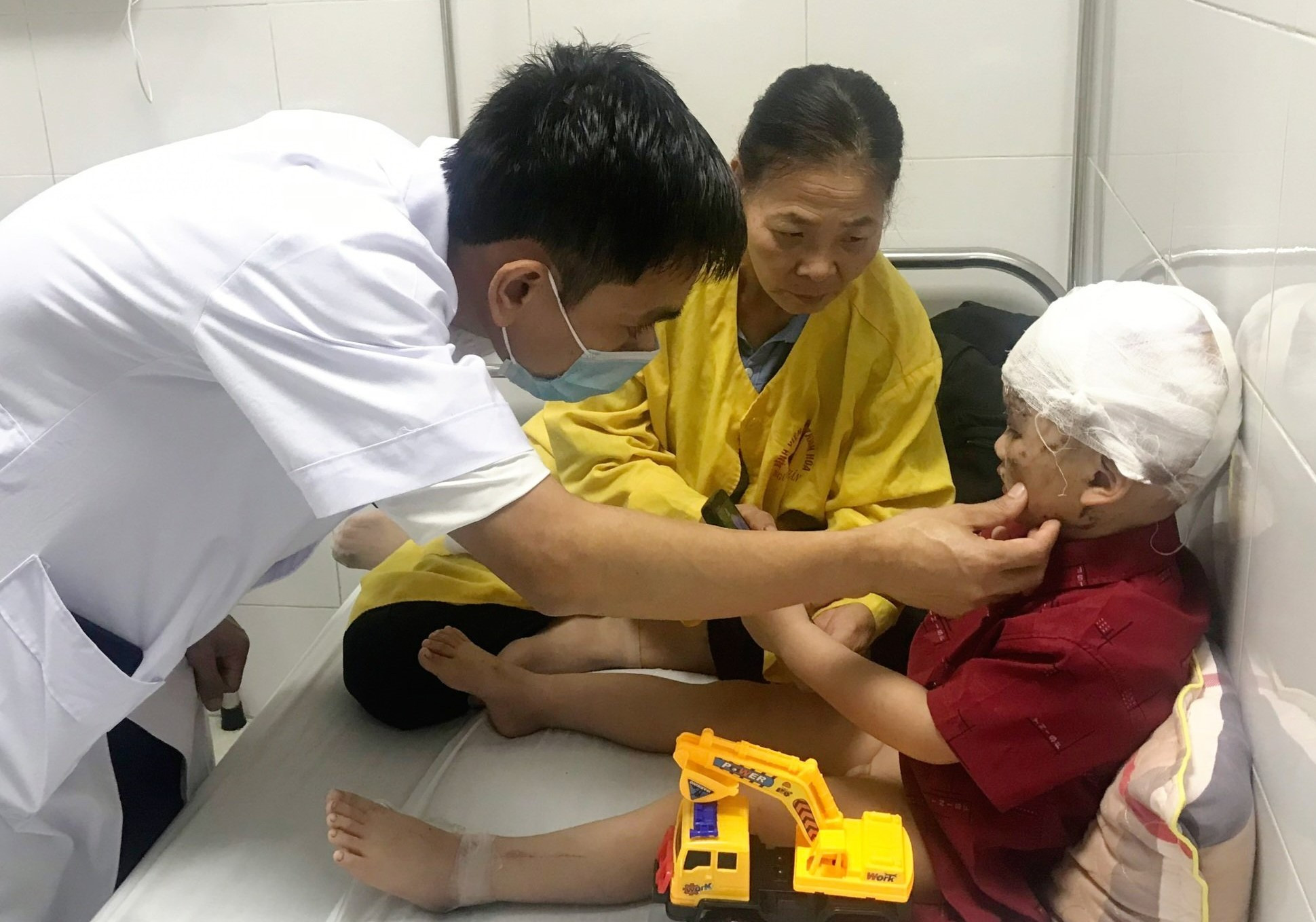 Bé 2 tuổi ở Thanh Hóa bị chó cắn nát mặt