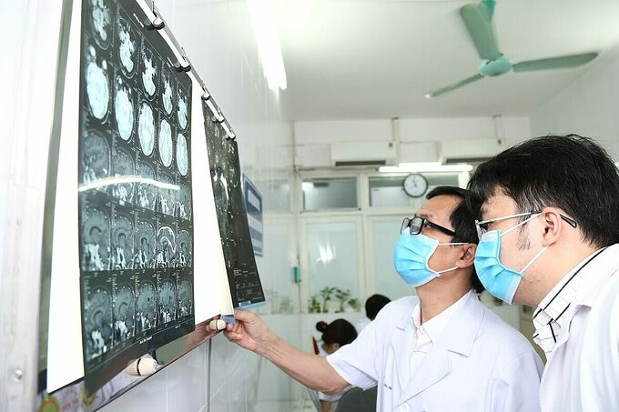 Bất ngờ phát hiện bệnh não rất nhiều người Việt bị chỉ qua cơn đau đầu