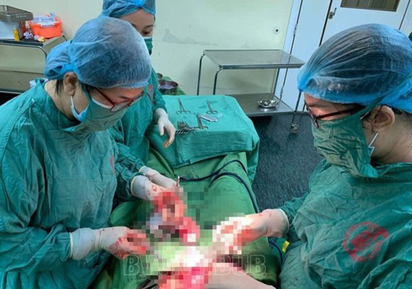 Vietnamese doctors conduct surgery on woman with two wombs carrying twin in each