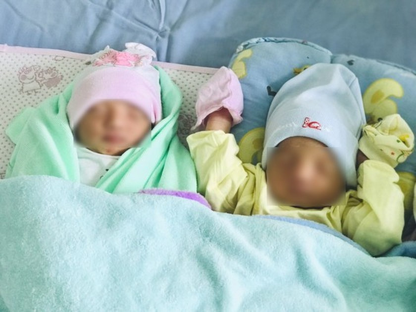 Twin with one in amniotic sac given birth in Vietnam ảnh 1