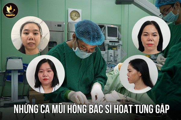 Vị bác sĩ 'chữa lành' những ca phẫu thuật mũi hỏng