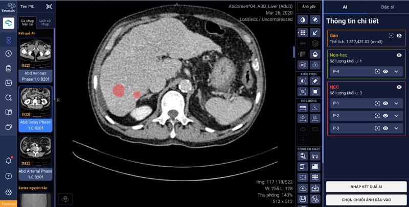 VinBrain hợp tác BV Đại học Y Dược TP.HCM ứng dụng AI chẩn đoán ung thư gan
