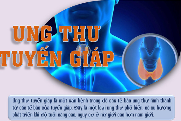 Loại ung thư có thể chữa khỏi nếu phát hiện sớm