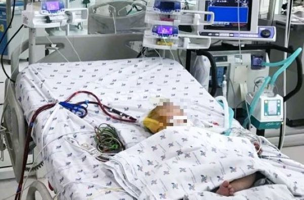 Trẻ 7 tháng tuổi co giật liên tục khi mắc sốt xuất huyết