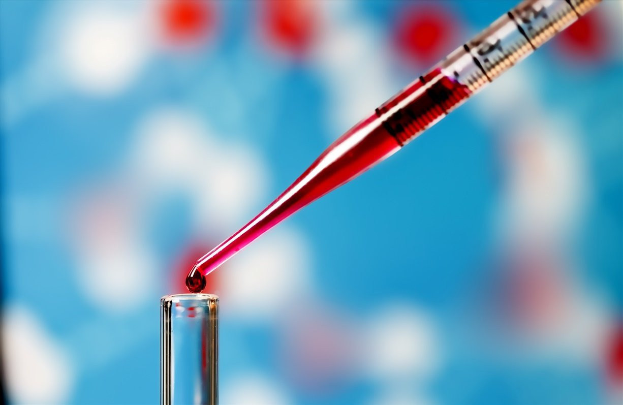 Xét nghiệm máu có tầm soát được ung thư hay không?