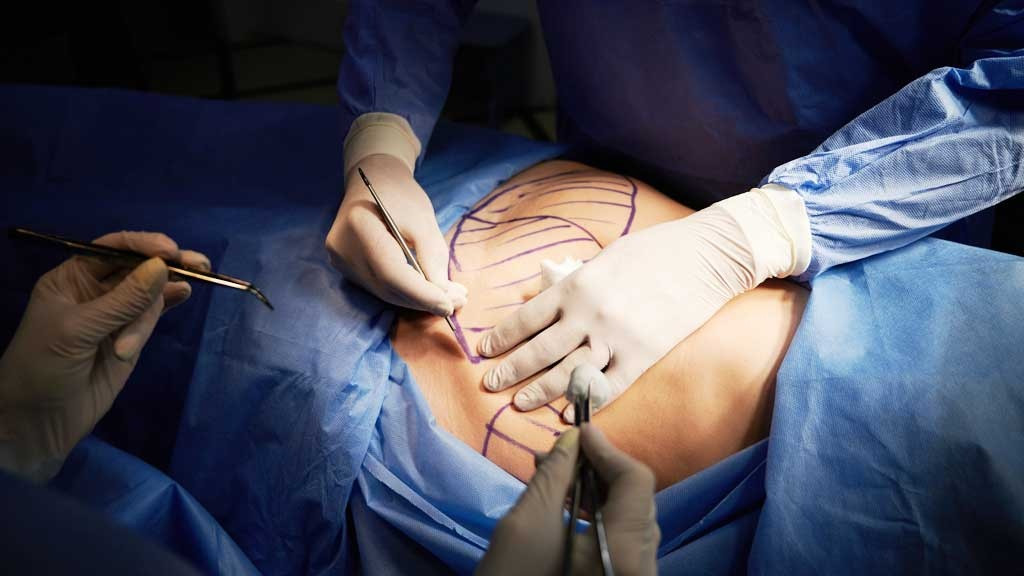 Cơ sở hút mỡ khiến cô gái 25 tuổi tử vong chỉ đăng ký 'chăm sóc da'