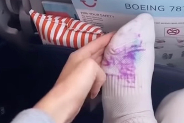 Gác chân ngủ trên máy bay, nữ hành khách bị vẽ bẩn chi chít lên tất