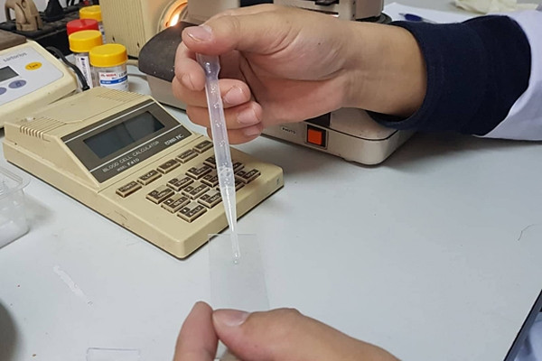 &apos;Tinh binh&apos; rất khỏe nhưng sao không thể có con?