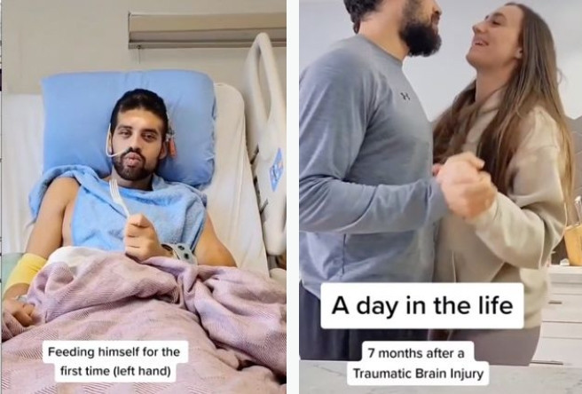 Tình yêu của vợ cứu sống người đàn ông bị chấn thương sọ não