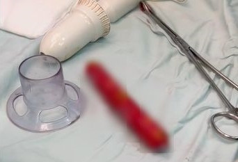 19-year-old boy masturbating got a sausage stuck in his anus