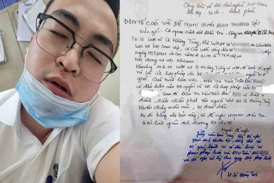 Vụ luật sư ‘tố’ điều tra viên hành hung, công an nói… trượt ngã