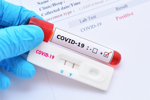 5 red warning signs when recovering from Covid-19 need urgent medical help