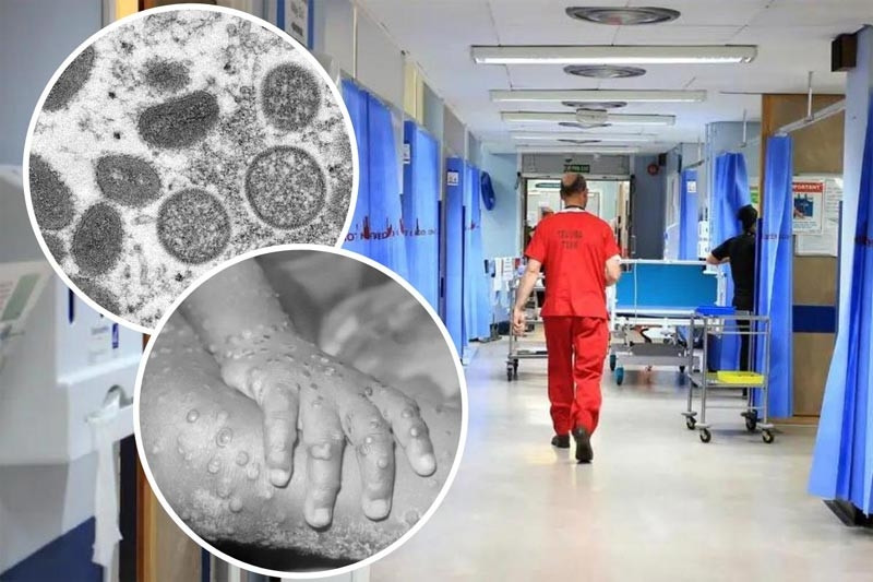 Rare monkeypox cases increase sharply in Europe, WHO holds emergency meeting