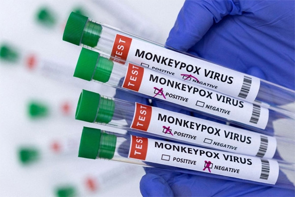 How long can a person with monkeypox be contagious?