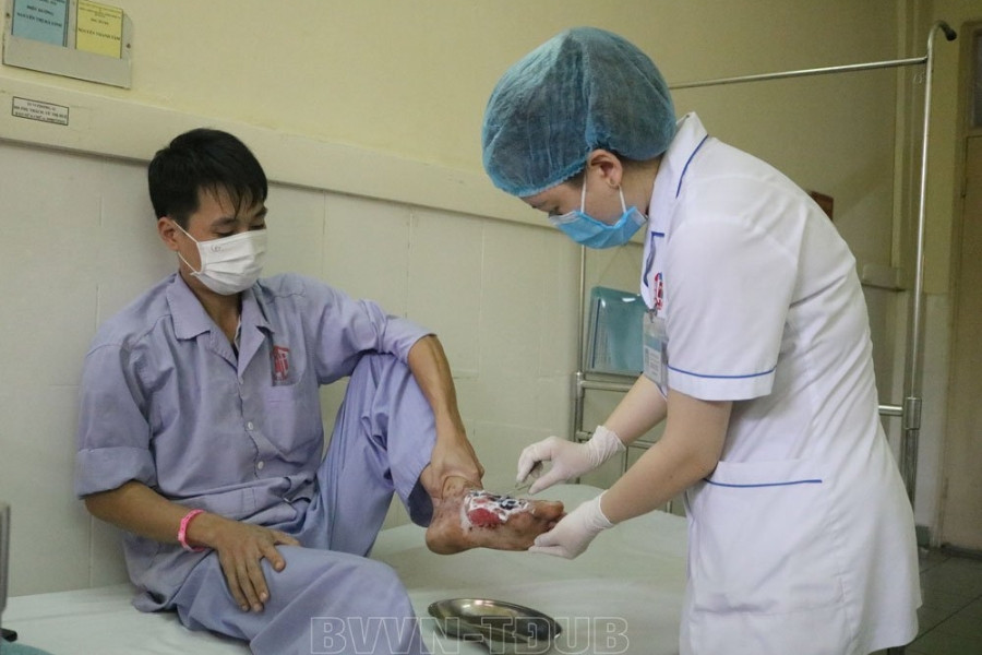 Hoại tử bàn chân do chữa bỏng bằng lông gà và thuốc ‘lạ’