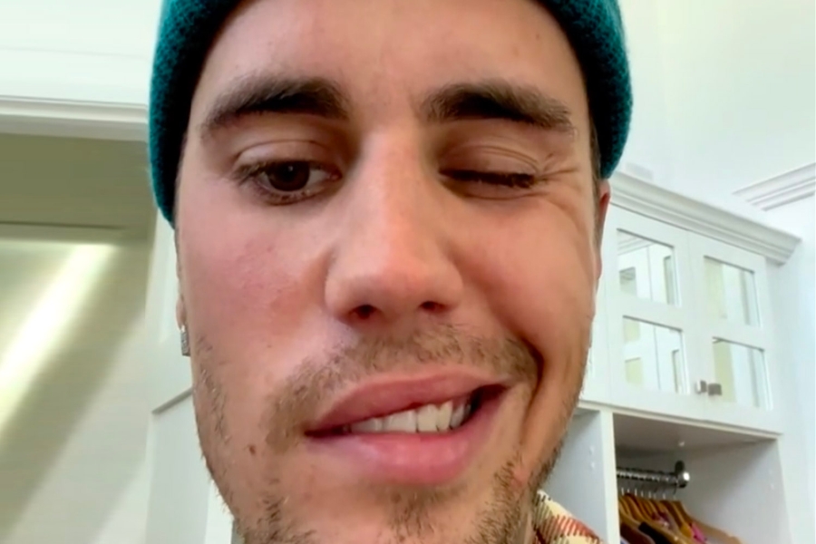 Justin Bieber hoãn tour diễn vì gặp virus hiếm khiến nửa mặt bị liệt