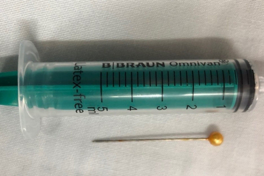 Hy hữu: Gắp một chiếc kim trong đường thở bé 10 tuổi