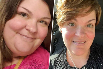 Nhờ giảm cân, người phụ nữ 39 tuổi phát hiện bị ung thư