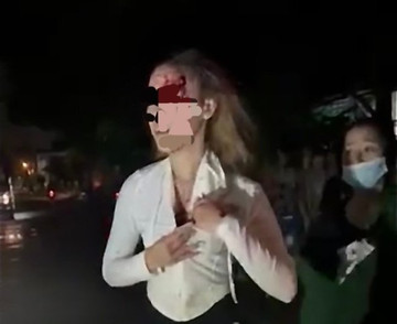 Nữ công nhân 19 tuổi ở Bình Dương bị chặn đánh hội đồng, khâu 7 mũi