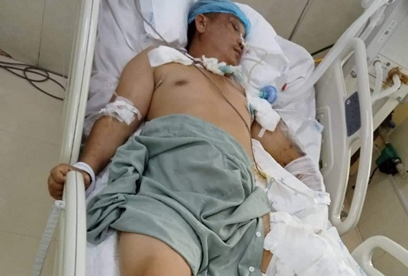 Anh Phùng Văn Long bị tai nạn giao thông đã được xuất viện về nhà