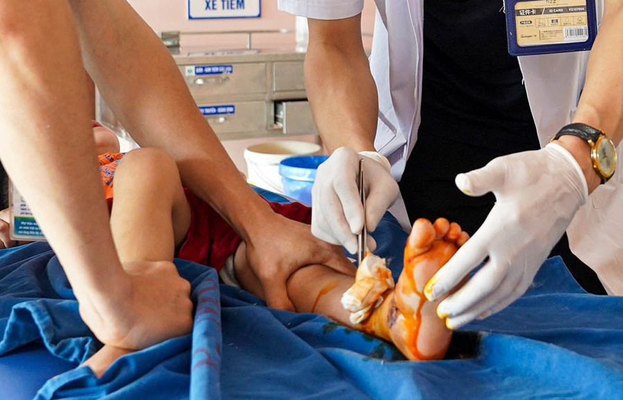 Bé 2 tuổi ở Hà Nội bị nát bàn chân, vỡ xương do cửa tự động