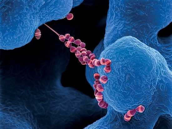 Chỉ mổ lợn, người đàn ông bất ngờ nhiễm loại khuẩn nguy hiểm