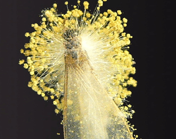 10 ngày sau ăn món khoái khẩu, người đàn ông Hà Nội tử vong