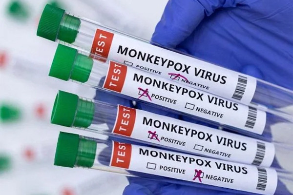 Monkeypox can be spread through the air