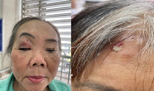 TP.HCM lập hội đồng chuyên môn, tìm nguyên nhân gây 