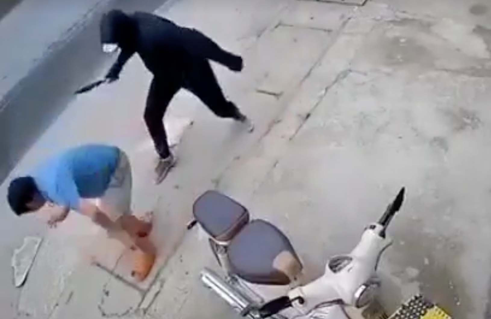 Người đàn ông bị chém lìa chân khi đang đi bộ