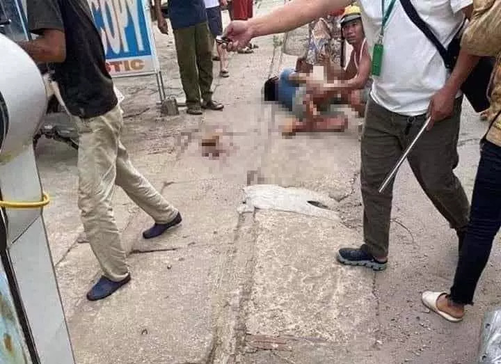 Điều chờ đợi kẻ thủ ác chém lìa chân nạn nhân ở Hà Nội