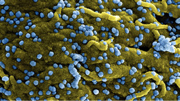 WHO báo động về đợt bùng phát mới của virus chết người