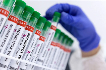 Bộ Y tế hướng dẫn phân biệt đậu mùa khỉ với thủy đậu, tay chân miệng hay Herpes lan tỏa