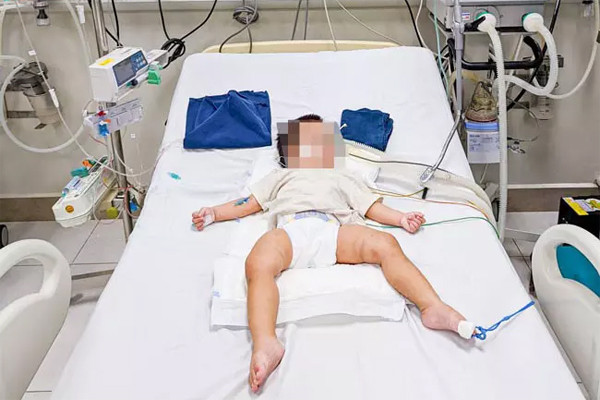 Hình ảnh vết lằn, bầm tím trên người bé 1 tuổi nghi bị bạo hành ở Hà Nội