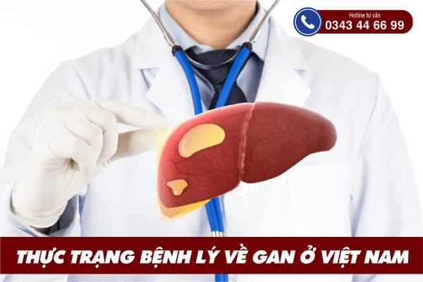 Báo động thực trạng bệnh lý về gan