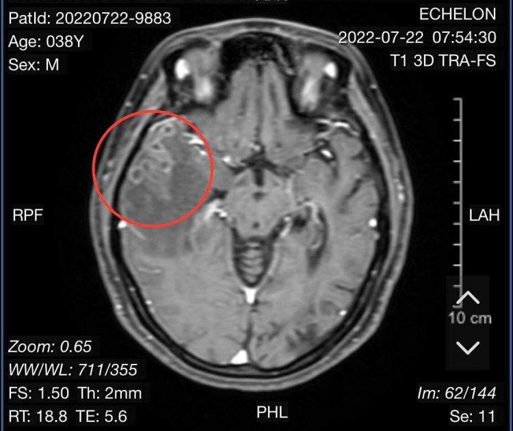 Cách nuôi dạy một thần đồng