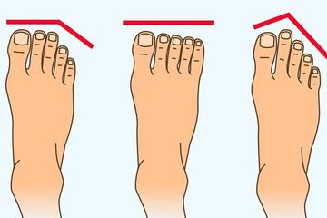 Hình dáng của bàn chân có thể nói lên những gì về tính cách con người?